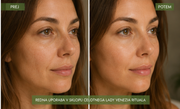 LIFTING SERUM ALOE VERA